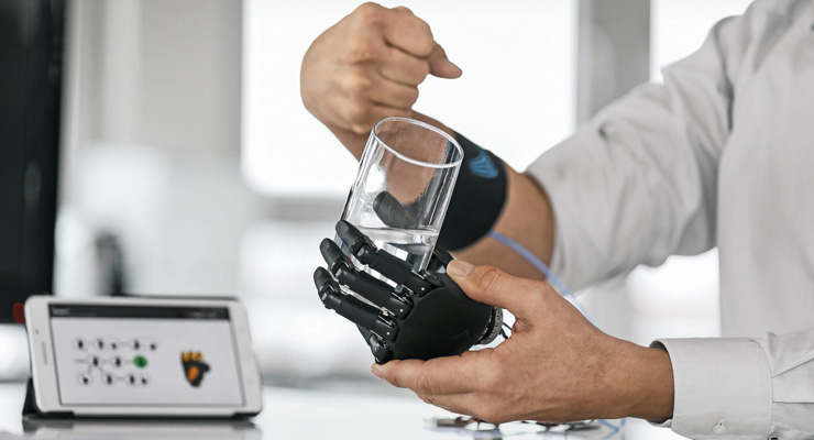 “The world of prosthetics is an engineer’s paradise”